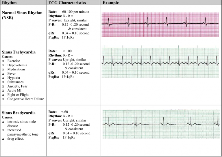 Why Interpretive EKG Machines are better than Non-Interpretive EKGs