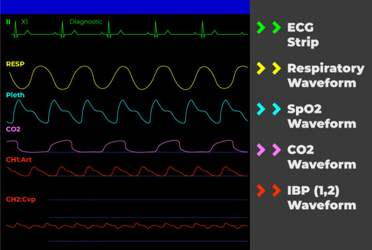 Patient Monitor Diagram