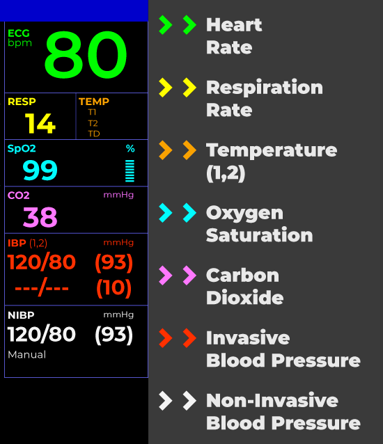 Ekg Monitor Screen