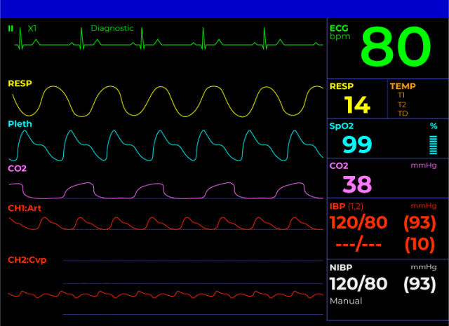 GE B105M/B125M/B155M Patient Monitor - CardiacDirect