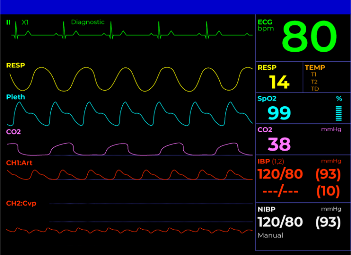 How To Read A Patient Monitor Numbers And Lines Explained