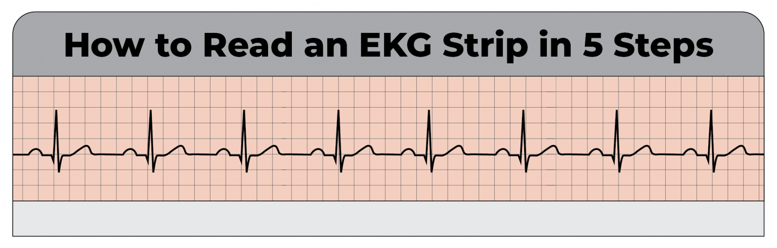 How to Read an EKG Strip in 5 Steps - CardiacDirect