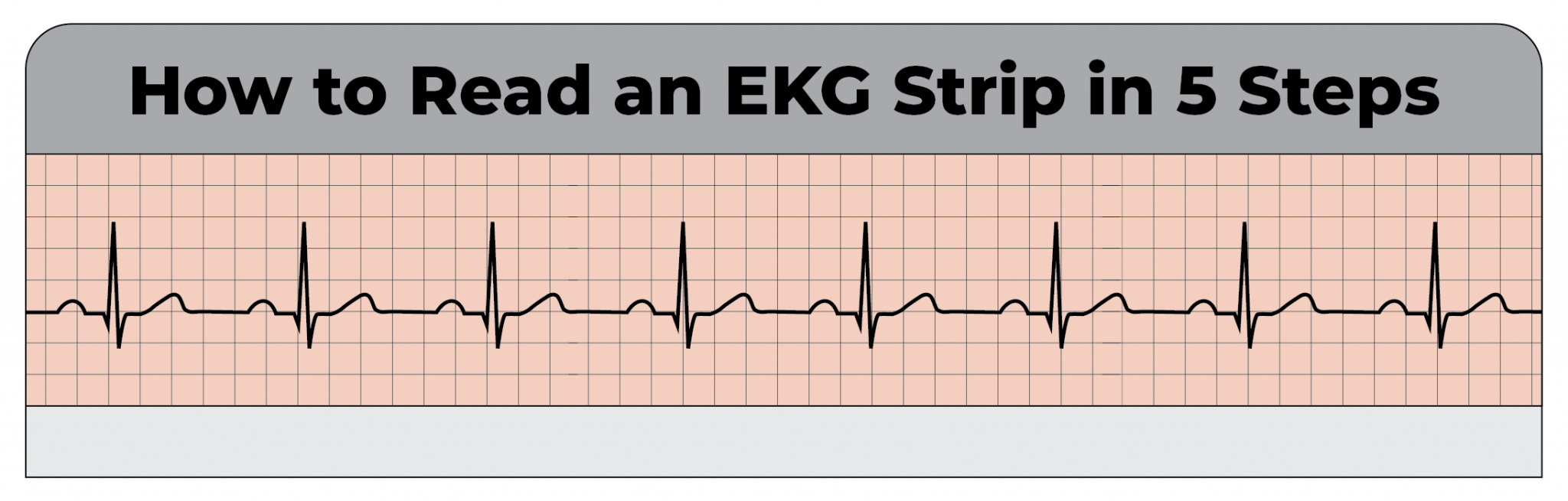 How to Read an EKG Strip in 5 Steps - CardiacDirect