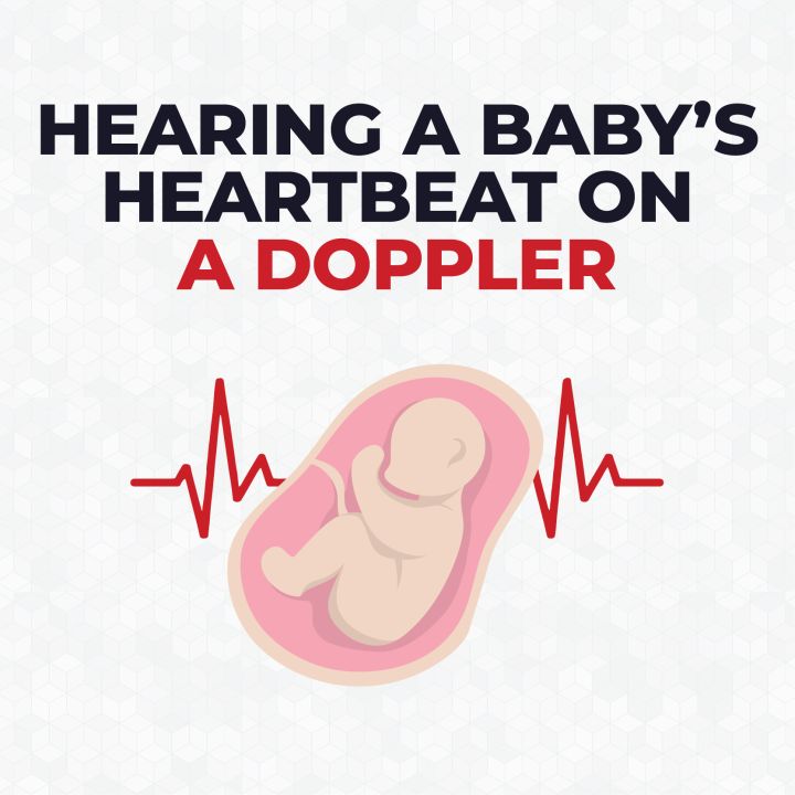 when-can-you-hear-a-baby-s-heartbeat-on-a-doppler-cardiacdirect