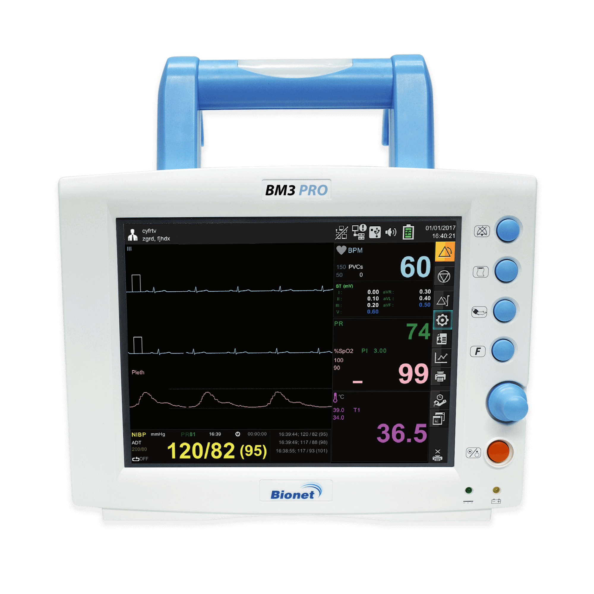 Bionet BM3 Pro Multi-Parameter Patient Monitor - CardiacDirect