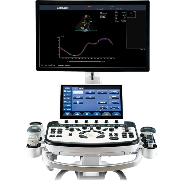 Chison XBit 90 Ultrasound Machine - CardiacDirect