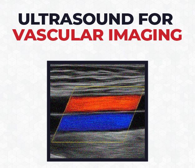 Ultrasound-for-Vascular-Imaging_Cover