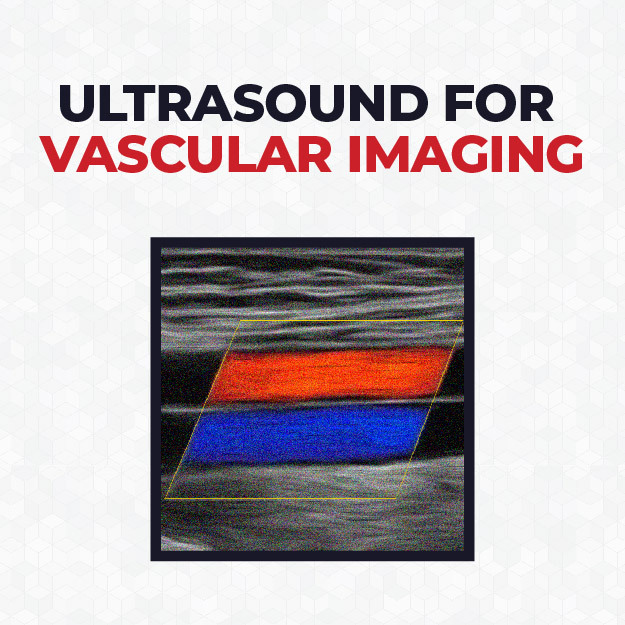 Ultrasound-for-Vascular-Imaging_Cover