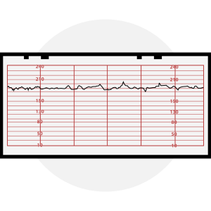 Icons_Increased Fetal Heart Rate