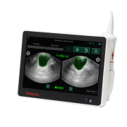 Vitacon eVue Bladder Scanner