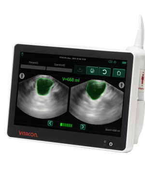 Vitacon eVue Bladder Scanner