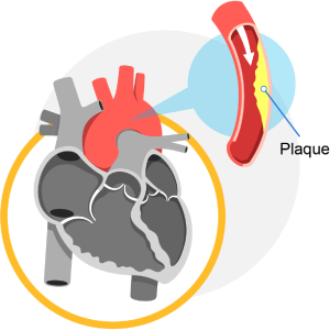 Icons_Diagnose Heart Conditions